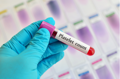 (PRP Treatments) - Platelet Therapy, What to know before you go